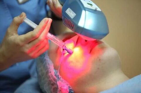 Biorevitalizimi me laser i lëkurës së fytyrës